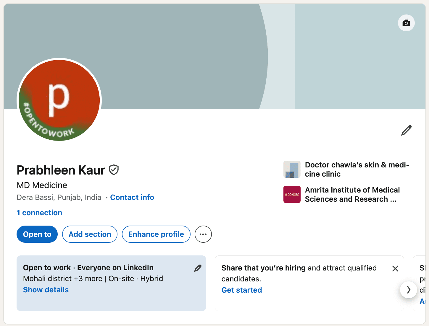 LinkedIn Profile Before Optimization
